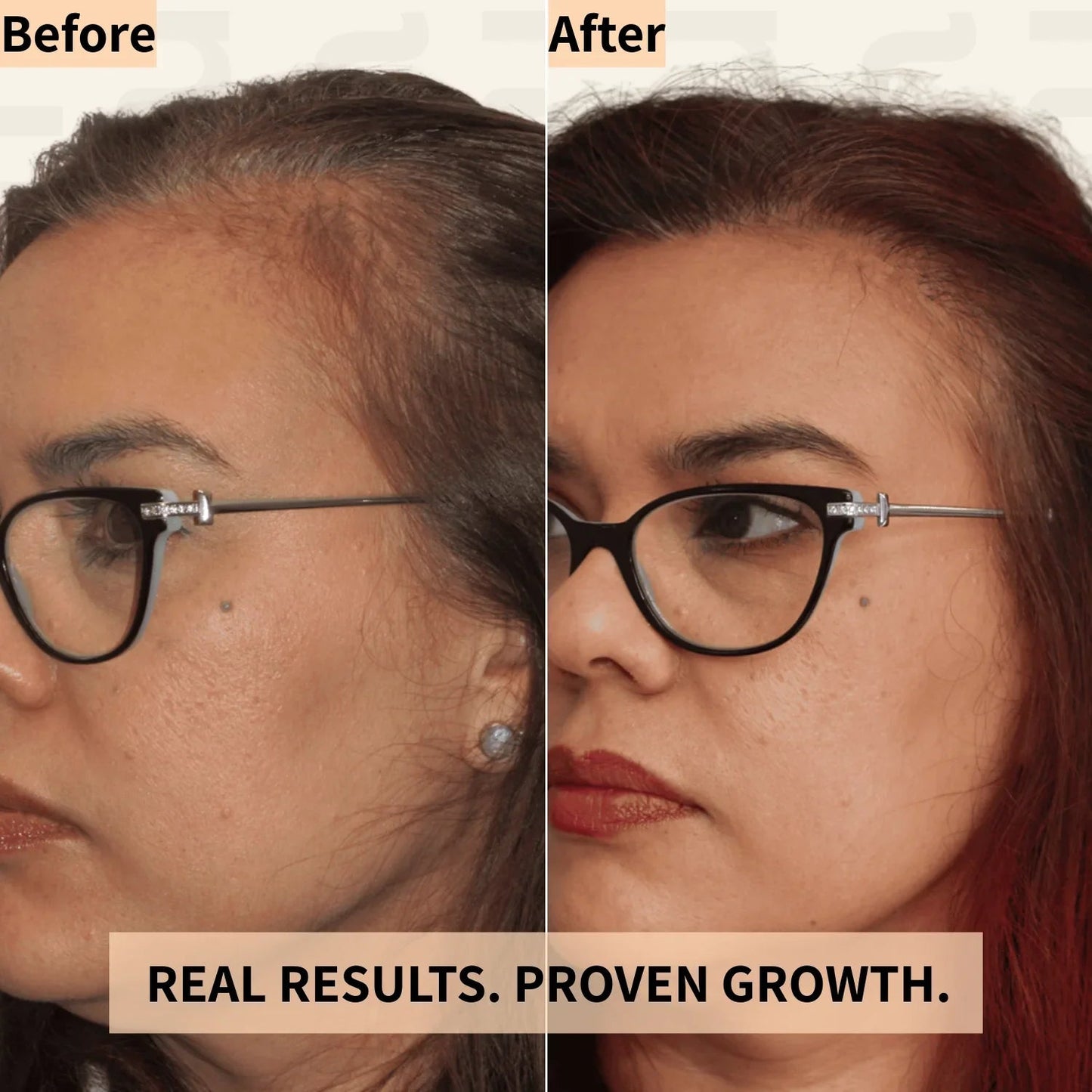 Hair Growth Massager Pro™