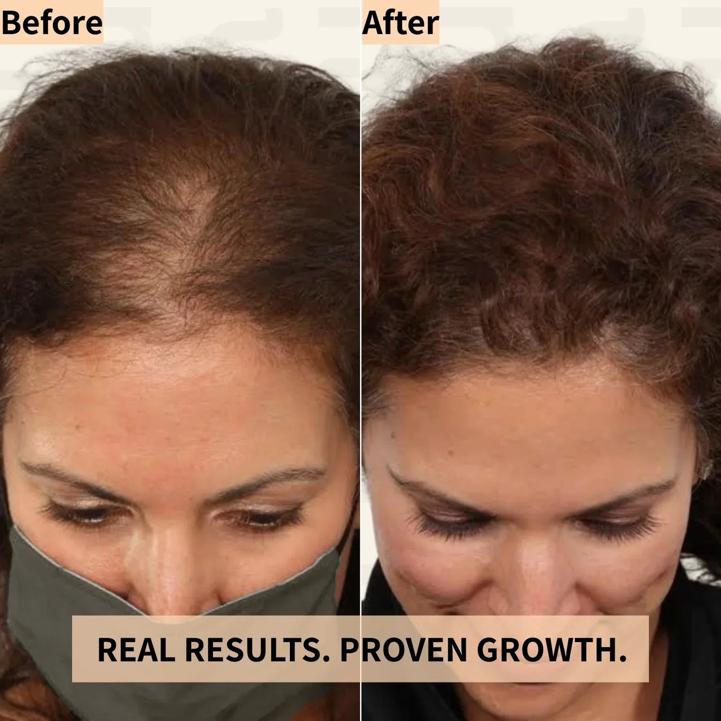 Hair Growth Massager Pro™